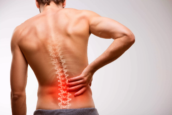 Backache Sciatica